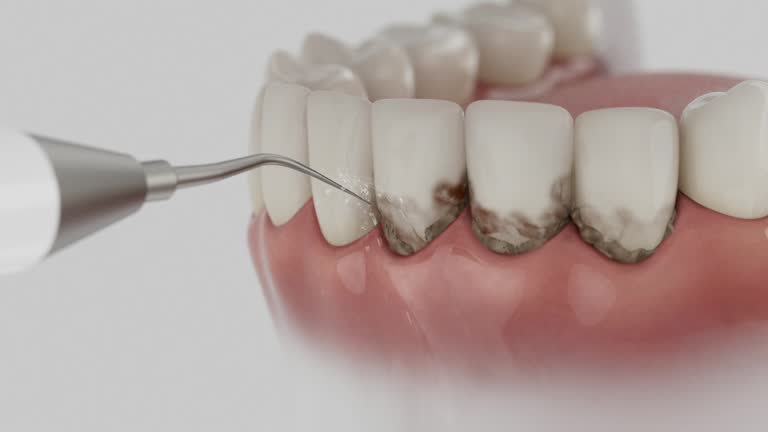 Reliable Root Canal Treatment contractor in Perry County County, AR by Dentist Open Now